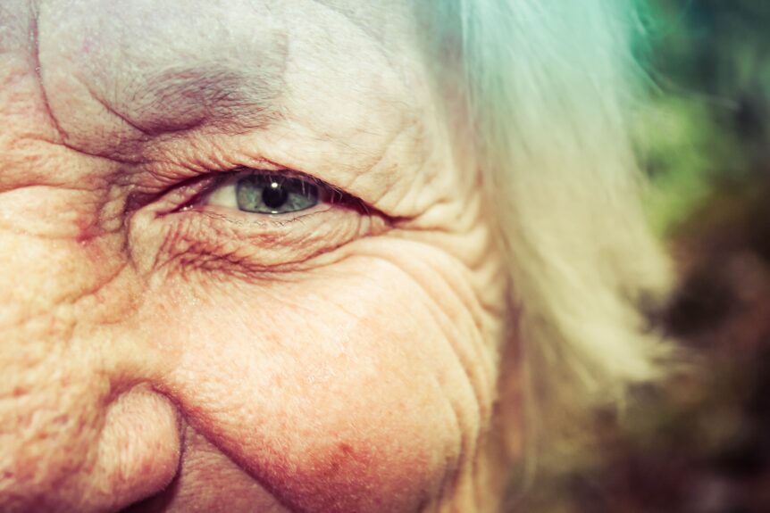 how to reduce under eye wrinkles
