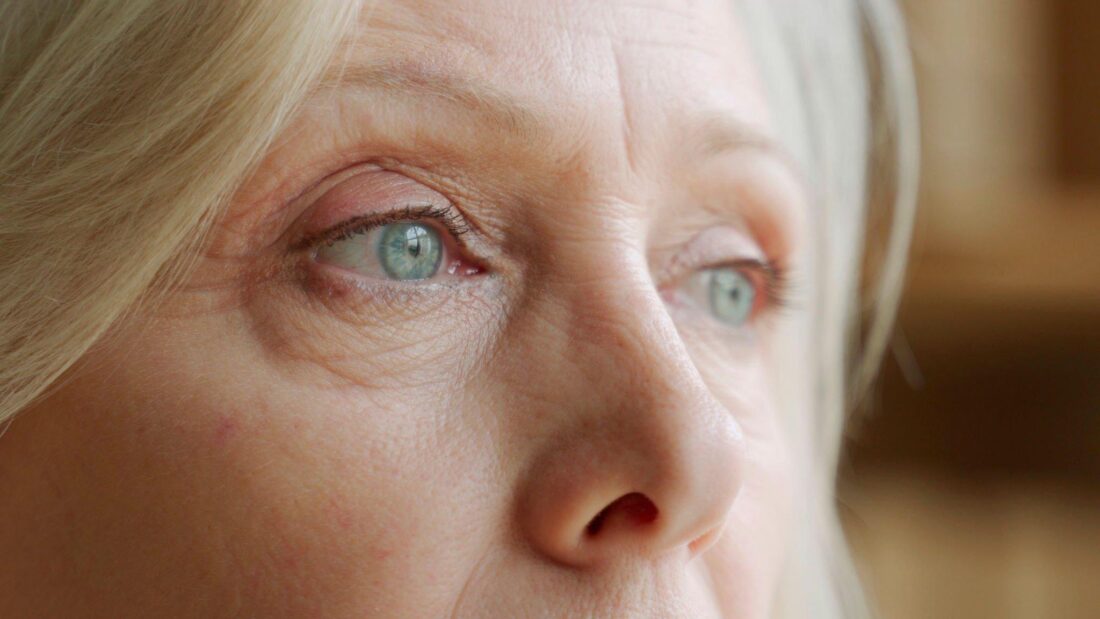 eyelid wrinkles