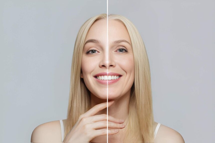 how to reduce wrinkles