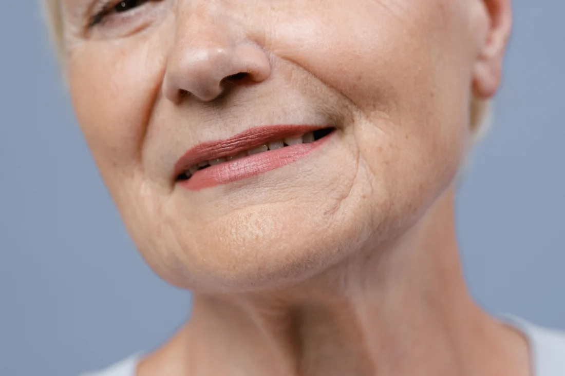 does vaping cause wrinkles